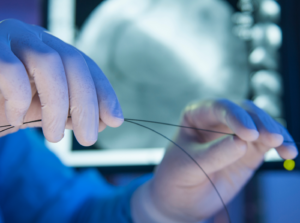 Using Medical Wire